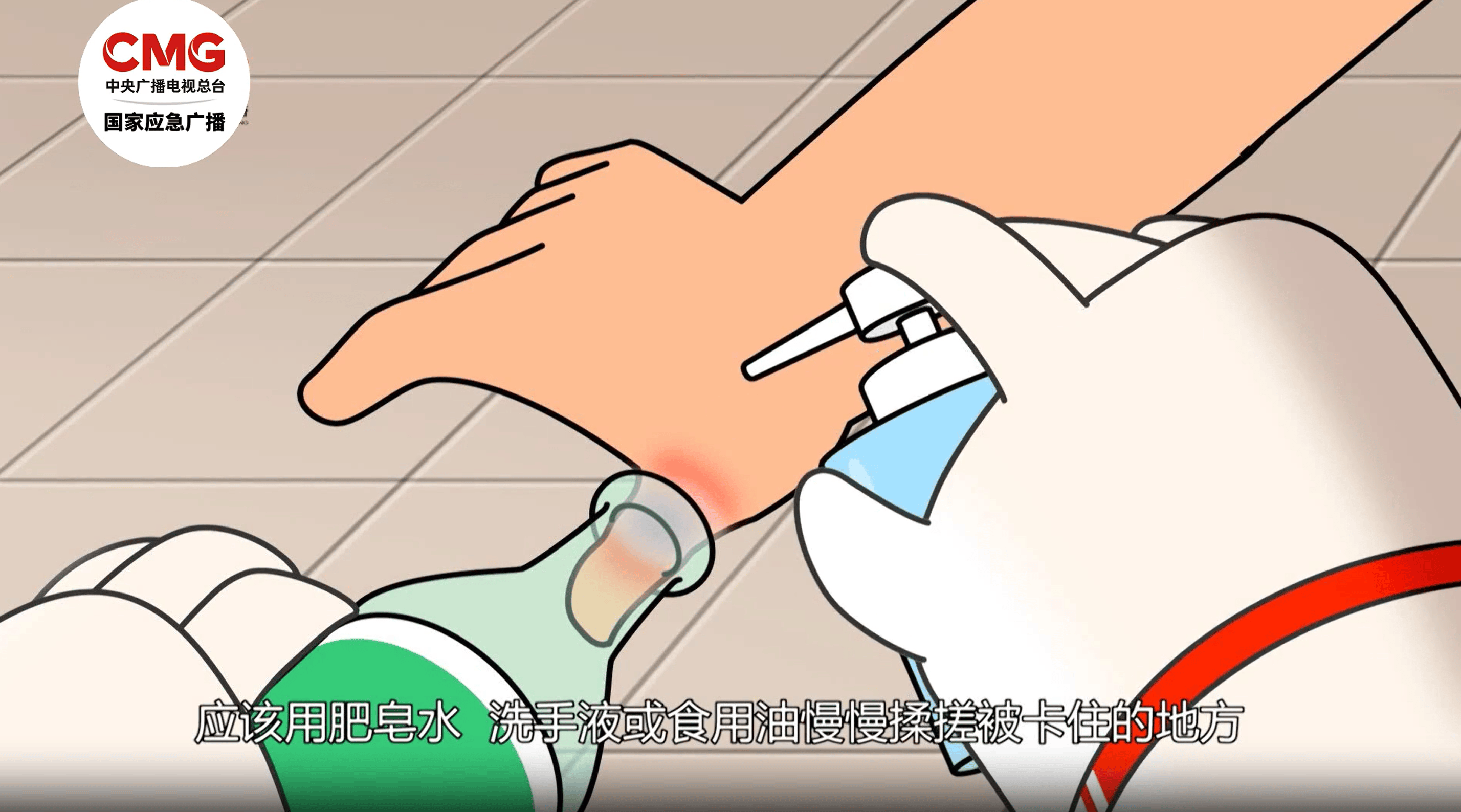 男子昏迷数日无人知竟是被卡在家中 居家意外伤害这样防范