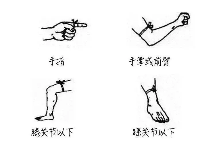 游客三亚疑被蛇咬身亡,当地曾公布3家医院有抗蛇毒血清