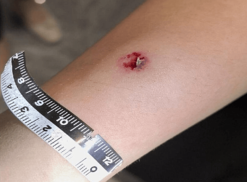 杭州警方通报：4名伤者均为女性