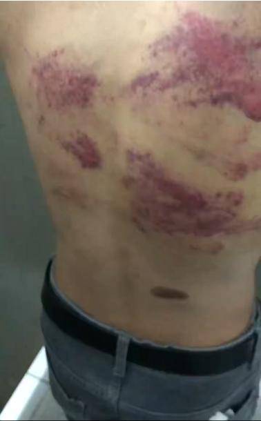 21岁小伙被骗缅甸妙瓦底，父亲：他用支付宝发消息求救，完不成百万美金业绩遭殴打