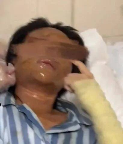 女主播称遭伪装快递包裹炸伤,湖南警方通报